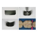 GDC Double Ended T-Burnisher 3 03