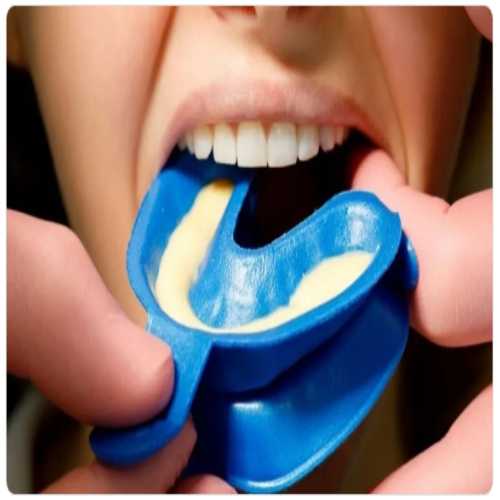 Oro Disposable Fluoride Impression Trays 05